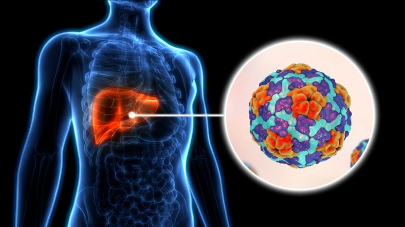 kasus Hepatitis A di eropa meningkat drastis